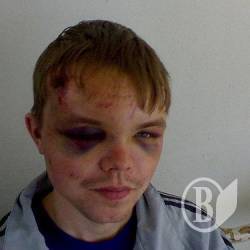 Як діяти в разі нападу Як діяти в разі нападу