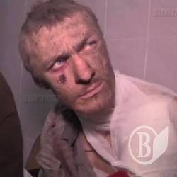 УВАГА! Допоможіть упізнати полоненого чернігівця Івана, якого бойовики лікують у Донецьку УВАГА! Допоможіть упізнати полоненого чернігівця Івана, якого бойовики лікують у Донецьку
