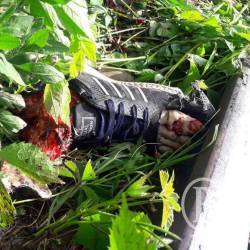 Поїзд відтяв п’яному ногу Поїзд відтяв п’яному ногу