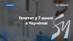  7-    5  