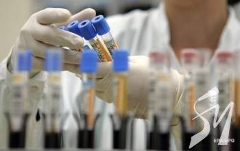 В Україні зафіксовано вже 548 випадків коронавірусу В Україні зафіксовано вже 548 випадків коронавірусу