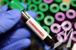 У Збройних силах зареєстровано 7 інфікованих COVID-19 У Збройних силах зареєстровано 7 інфікованих COVID-19