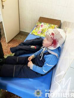 Постраждала сім'я з 4-річною дитиною: подробиці російського обстрілу прикордоння Чернігівщини Постраждала сім'я з 4-річною дитиною: подробиці російського обстрілу прикордоння Чернігівщини